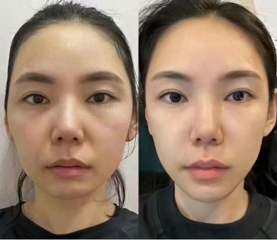 024最值得入手的抗皱国货分享OG真人抗老去皱纹护肤品推荐2(图3)